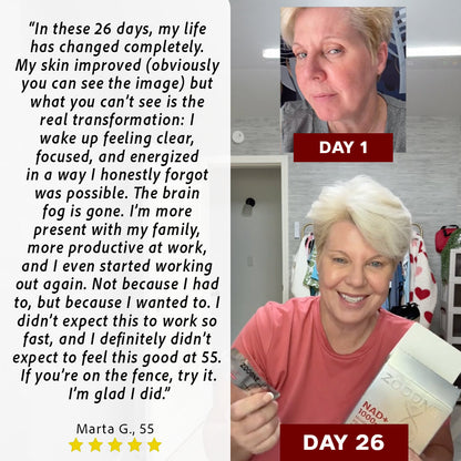 NAD+ 1000™ Mito Boost Sticks